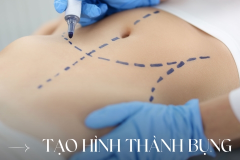 Tạo Hình thành bụng